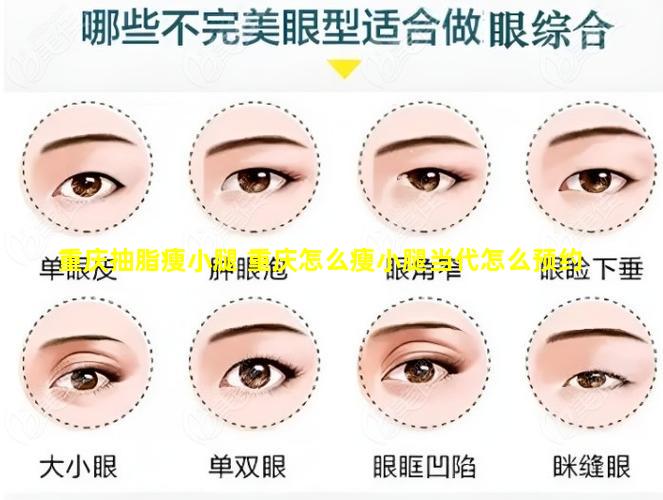 重庆抽脂瘦小腿 重庆怎么瘦小腿当代怎么预约